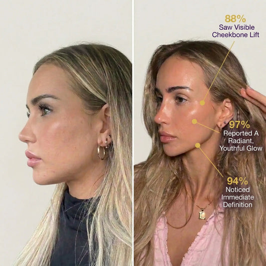 Sculpting PRO: The Natural, Non-invasive Facelift